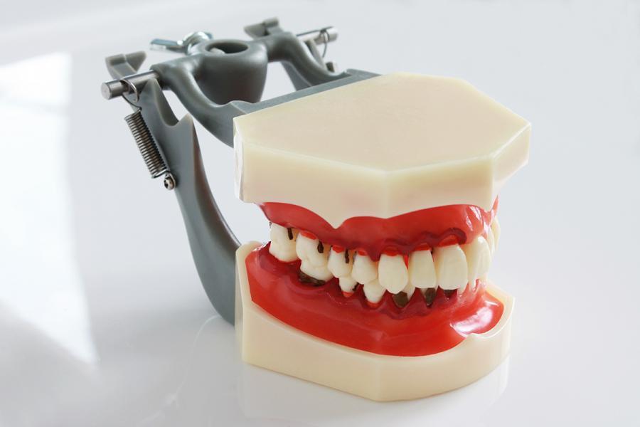 Зубы для фантома